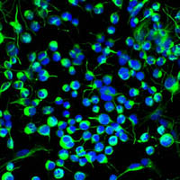 adult neural stem cells