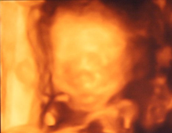Sagan Ultrasound 20 Weeks into Pregnancy