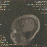 Ryan's MRI: Side View of the Head