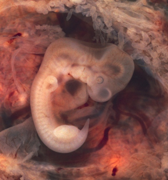 Human Embryo (7th week of pregnancy)